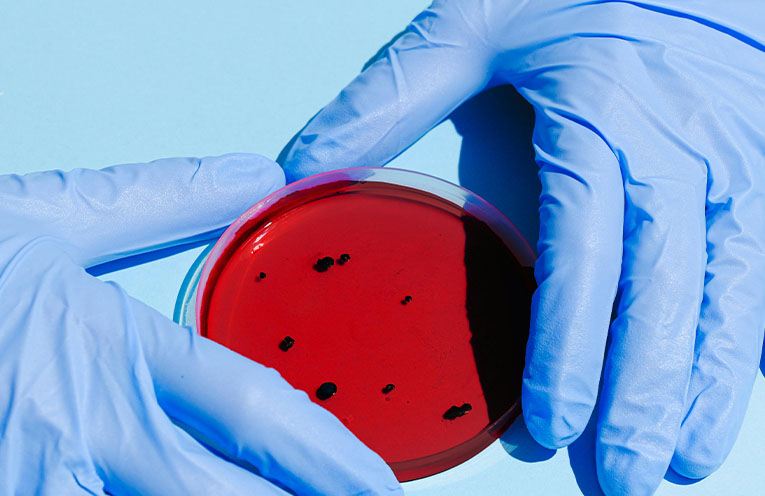 Health alert: Australian bat lyssavirus warning for Port Macquarie residents